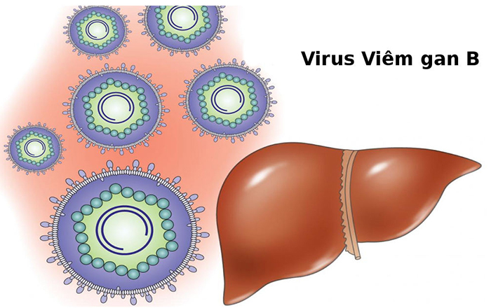 Viêm gan B là bệnh nhiều người mắc phải