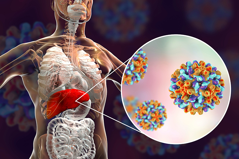 Số ca nhiễm virus viêm gan B ngày càng tăng trở thành nỗi lo của toàn cầu