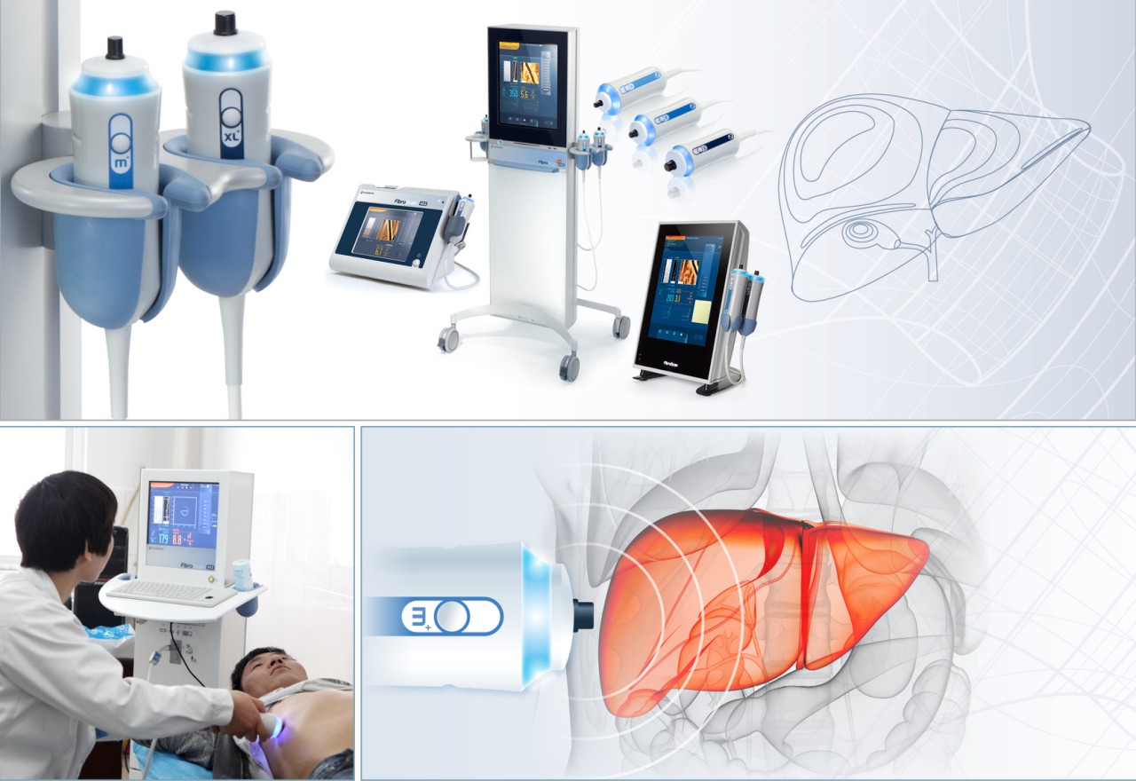 bảo vệ lá gan khỏe mạnh qua siêu âm Fibroscan