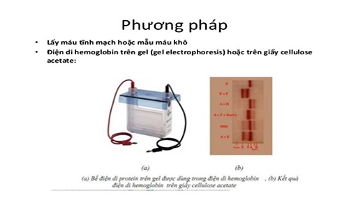 xét nghiệm điện di huyết sắc tố tại MEDLATEC an toàn, nhanh chóng, chính xác