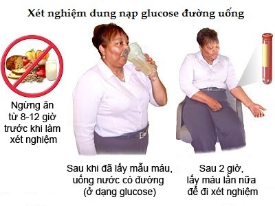 Xét nghiệm dung nạp glucose đường uống