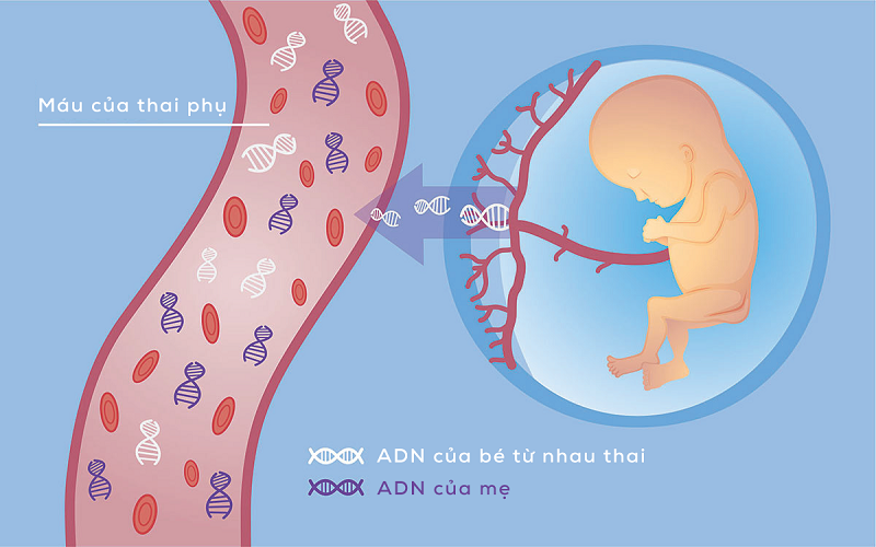 Xét nghiệm NIPT thực hiện qua lấy máu tĩnh mạch ở mẹ giúp giải trình tự toàn bộ ADN tự do của thai nhi trong máu mẹ