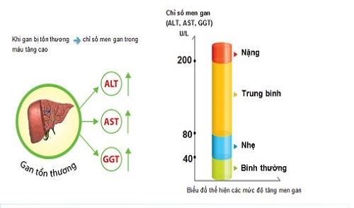 chỉ số AST/ALT đánh giá mức độ viêm gan, xơ hóa gan