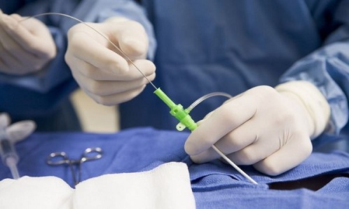 Đốt sóng cao tần - điều trị u tuyến giáp lành tính không cần phẫu thuật tại MEDLATEC