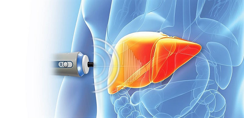 Nguyên tắc hoạt động của việc đo độ nhiễm mỡ gan (CAP) của FibroScan