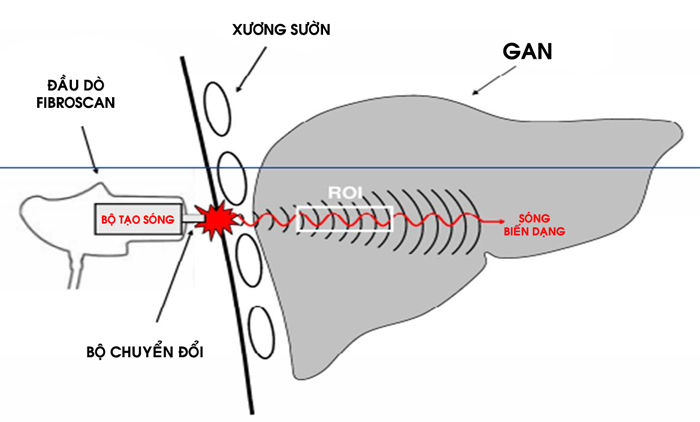 Nguyên lý hoạt động của máy firbroscan