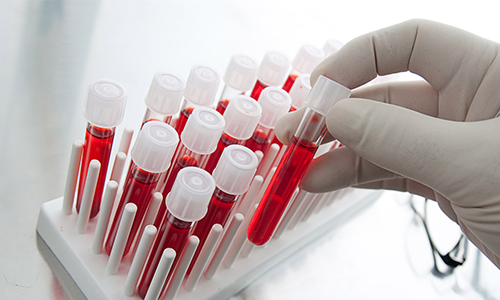 Xét nghiệm máu để kiểm tra và đánh giá chức năng gan