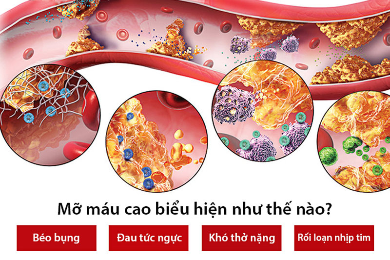 Khi xuất hiện các triệu chứng cảnh báo máu nhiễm mỡ thì nên đi khám ngay