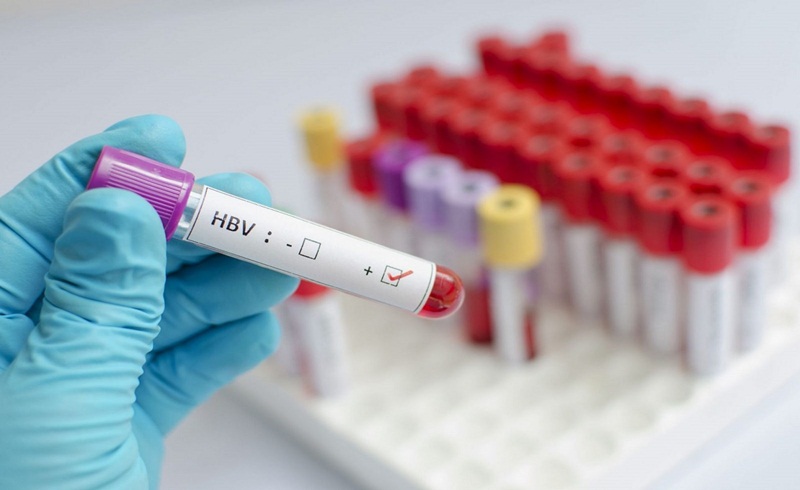 Xét nghiệm HbsAb để xác định về khả năng chống lại virus HBV của cơ thể