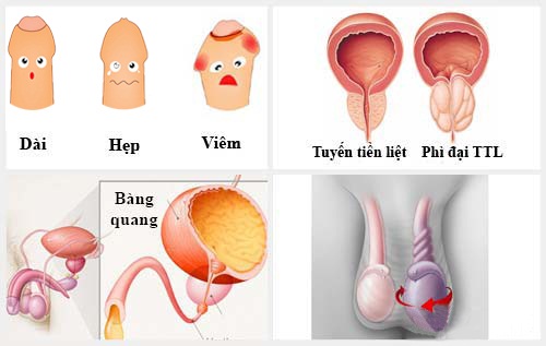 địa chỉ khám nam khoa uy tín ở Hà Nội