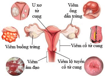 Mách bạn địa chỉ khám phụ khoa Hà Nội