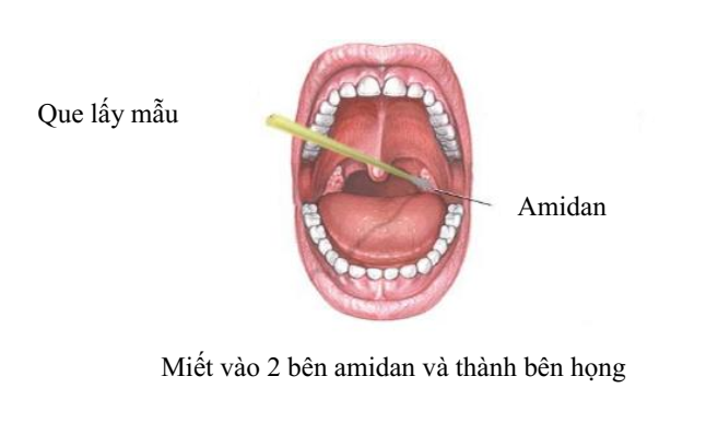 Dịch ngoáy họng