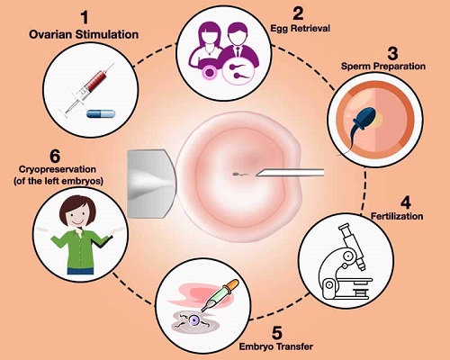 các phương pháp <a href='https://medlatec.vn/tin-tuc/cac-phuong-phap-ho-tro-sinh-san-pho-bien-hien-nay-s74-n12163'  title ='hỗ trợ sinh sản'>hỗ trợ sinh sản</a> phổ biến hiện nay