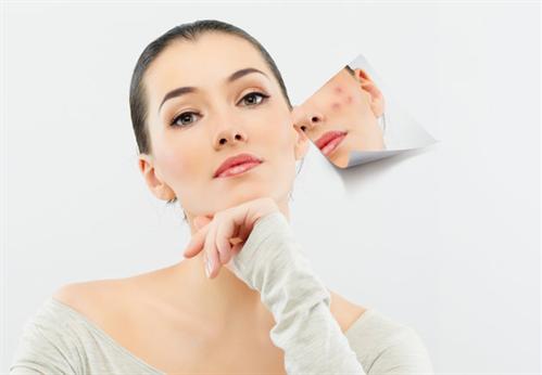 Tái tạo da bằng công nghệ Chemical Peeling