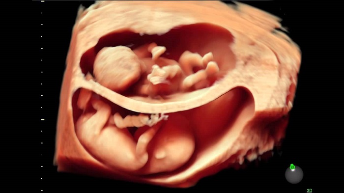 Siêu âm 12 tuần là một trong những trải nghiệm tuyệt vời nhất của mỗi bà mẹ đang mang thai. Hãy để bản thân được đắm chìm trong hình ảnh 4D siêu thực, một cảm giác khó tả khi chứng kiến vẻ đẹp siêu âm của bé yêu.