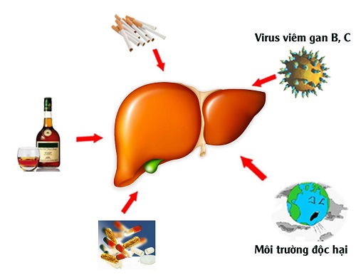 Nguyên nhân khiến bạn nên tầm soát ung thư gan sớm