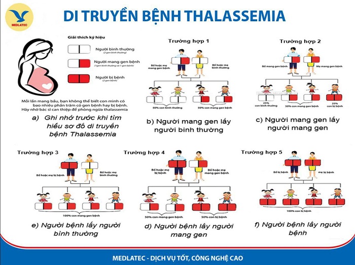 Tan máu bẩm sinh và những điều cần biết