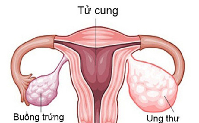 xét nghiệm dấu ấn ung thư MEDLATEC trả kết quả nhanh chóng, độ chính xác cao