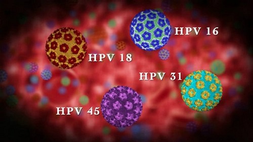 ung thư cổ tử cung có thể do nhiễm virus HPV