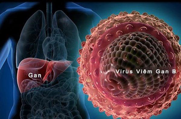         Viêm gan B do virus HBV gây ra và ảnh hưởng đến gan