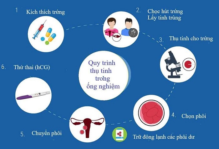 Thụ tinh trong ống nghiệm là phương pháp điều trị vô sinh được áp dụng phổ biến