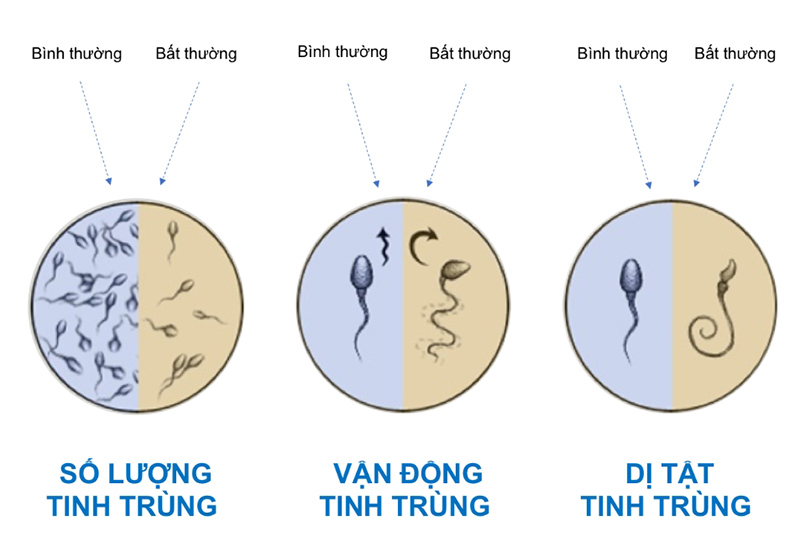 Chất lượng tinh trùng là yếu tố quan trọng, quyết định vấn đề thụ thai của cả hai vợ chồng