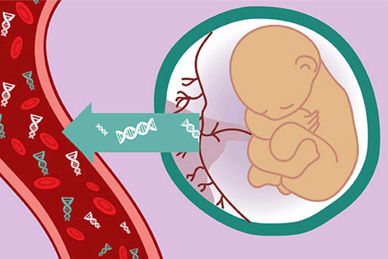 xét nghiệm NIPT có chính xác không là thắc mắc của nhiều mẹ bầu