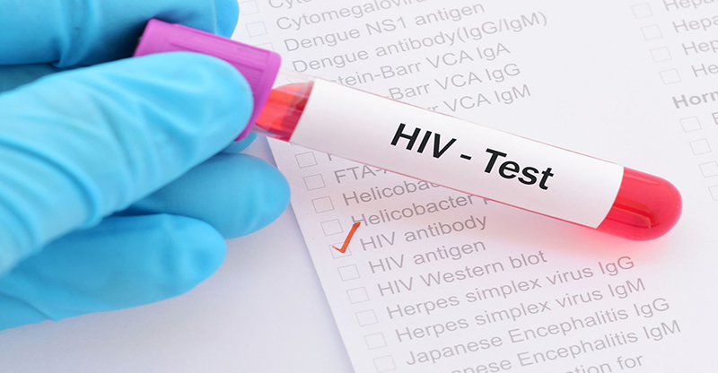 Mọi người nên thực hiện xét nghiệm HIV ít nhất một lần và xem nó như một phần tất yếu của quá trình chăm sóc sức khỏe định kỳ.