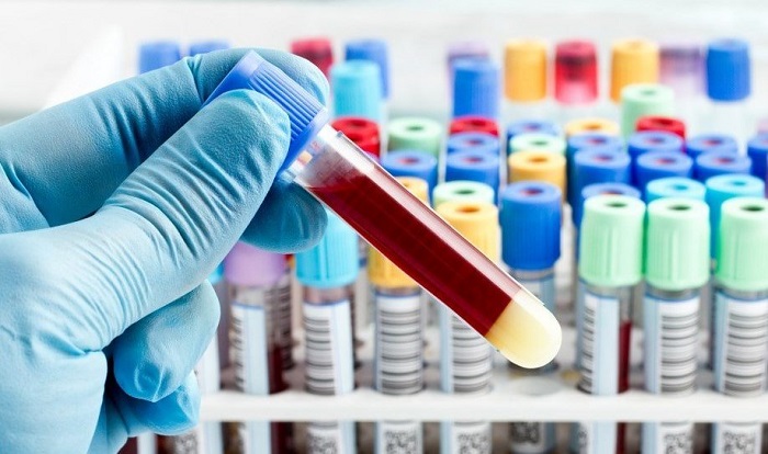 neut trong xét nghiệm máu là gì