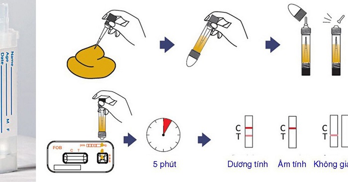 Xét nghiệm máu ẩn trong phân tầm soát ung thư đại trực tràng