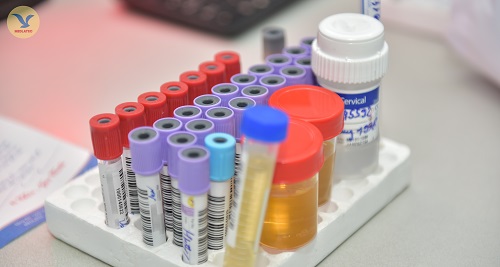 xét nghiệm định lượng virus viêm gan B