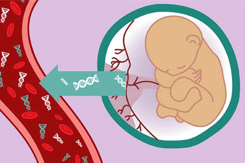 Xét nghiệm NIPT phân tích DNA thai thi