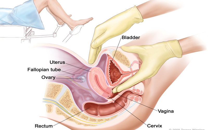 Xét nghiệm tế bào âm đạo là một trong những phương pháp giúp phát hiện sớm ung thư cổ tử cung ở phụ nữ