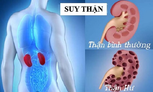 xét nghiệm Ure máu giúp kiểm tra tình trạng thận