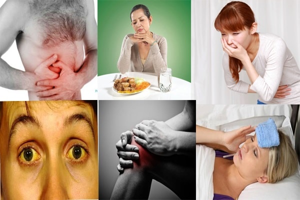 Triệu chứng của người bị nhiễm viêm gan virus C