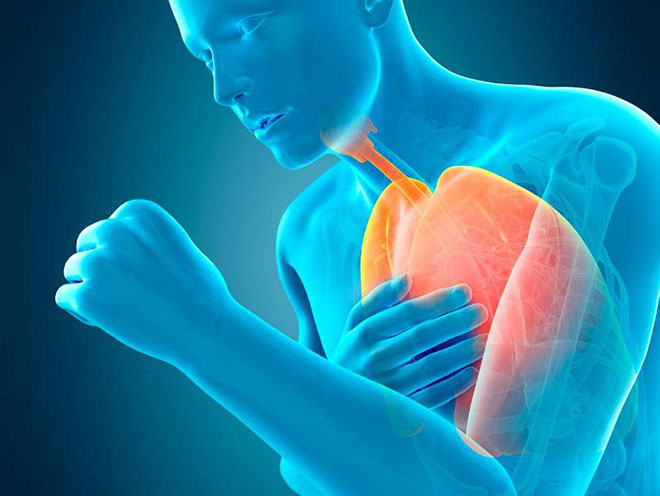 Khó thở cũng là biều hiện của nhiều bệnh lý nguy hiểm ở phổi
