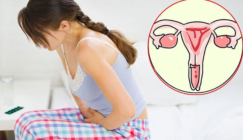 Chảy máu âm đạo và đau vùng chậu bất thường là một trong những dấu hiệu cảnh báo mắc ung thư cổ tử cung