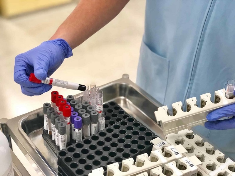 Xét nghiệm bao gồm công thức máu toàn bộ và phân biệt, xét nghiệm chức năng gan, nitơ urê máu, creatinin, glucose, điện giải, canxi huyết thanh và phân tích nước tiểu