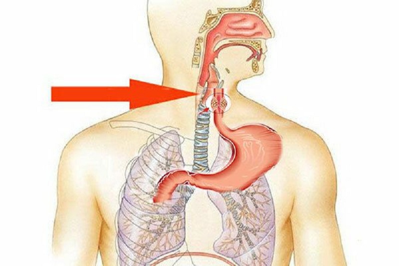 Sự hình thành các khối u lành tính hoặc ác tính rất khó để có thể tìm hiểu được nguyên nhân chính xác gây r