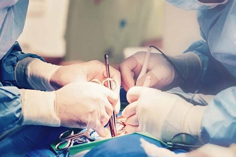 Phẫu thuật điều trị giãn tĩnh mạch thừng tinh