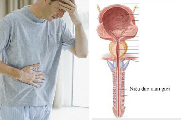 Đau tức vùng hạ vị sinh dục khi đi tiểu