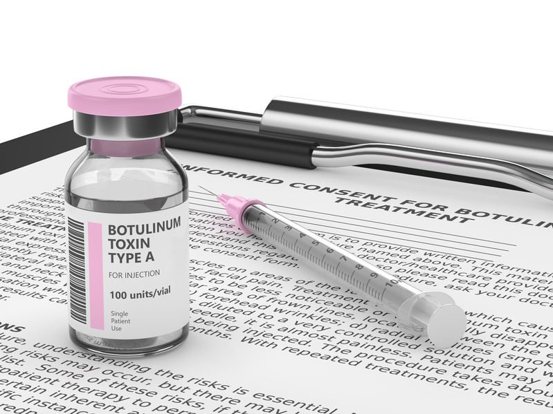 Tiêm BotulinumtoxinA (Botox) khi tiêm nhập cơ tạo ra liệt trong thời điểm tạm thời những cơ co cứng lại, có công dụng khoảng tầm 3 tháng