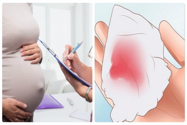 Ra máu âm đạo khi mang thai có thể là dấu hiệu thai chết lưu