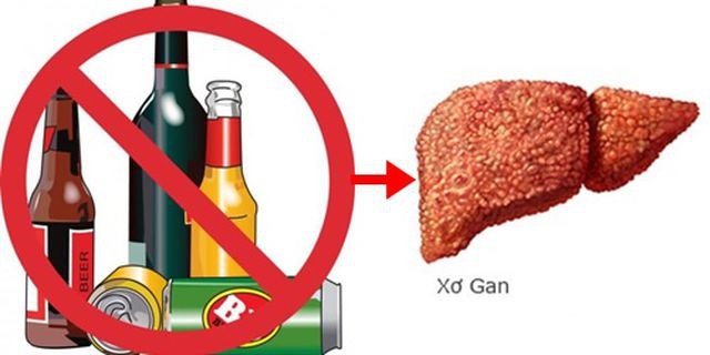việc sử dụng rượu bia với số lượng nhiều trong thời gian dài gây tổn thương gan