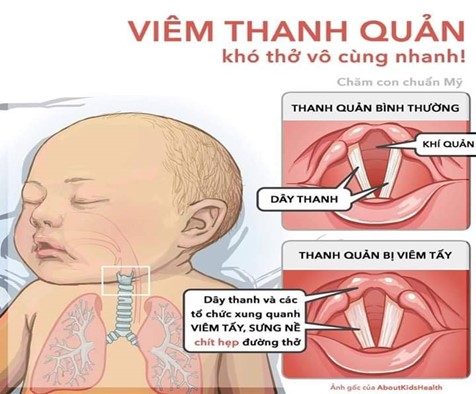 Phương pháp chăm sóc tại nhà