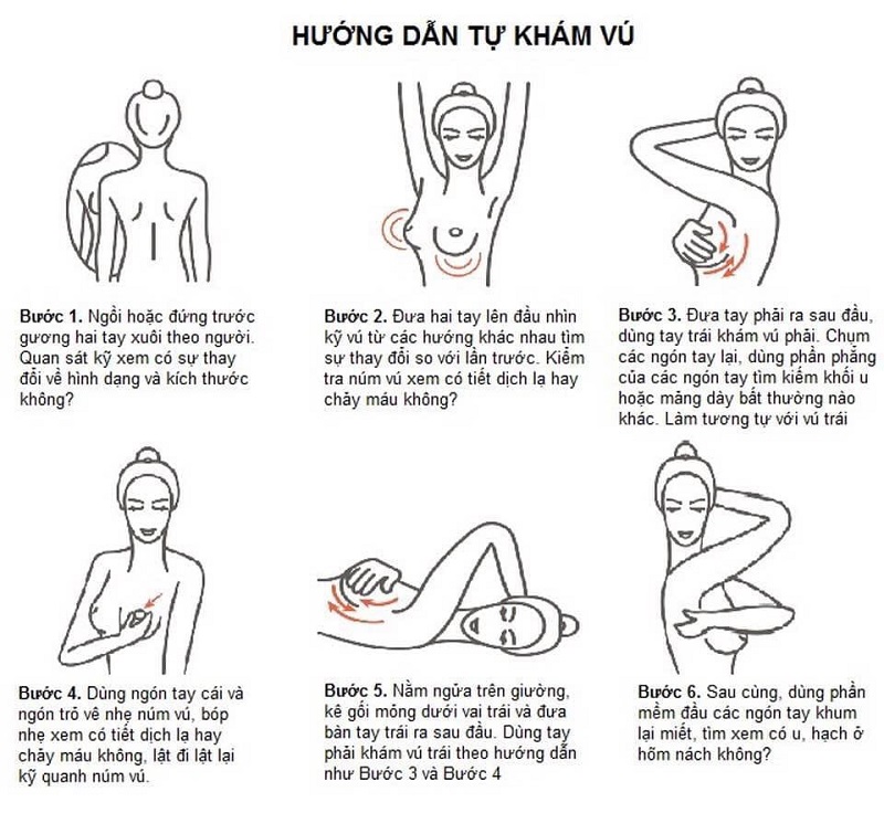 7. Phòng ngừa và theo dõi u vú lành tính