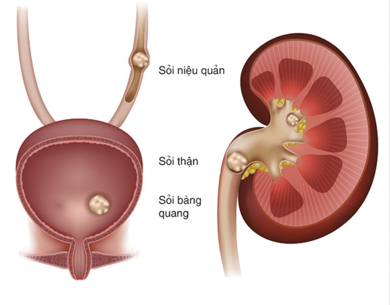 Áp Xe Tầng Sinh Môn Là Gì? Triệu Chứng và Phương Pháp Điều Trị Hiệu Quả