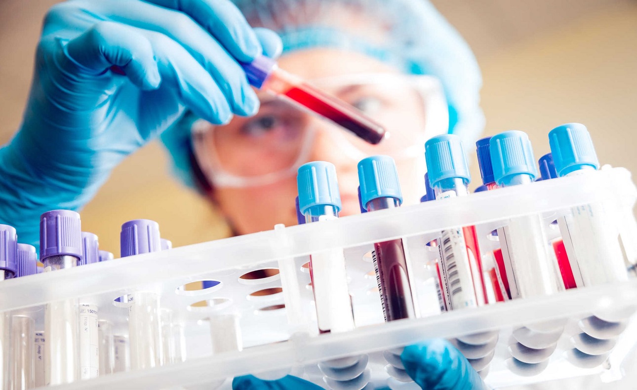 Xét nghiệm tổng phân tích tế bào máu 32 chỉ số | Medlatec