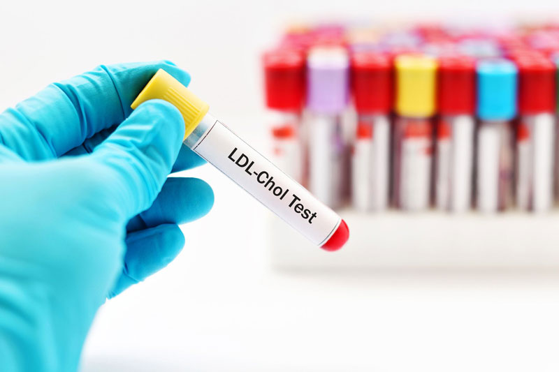 LDL cholesterol là gì, có liên quan gì đến sức khỏe? 