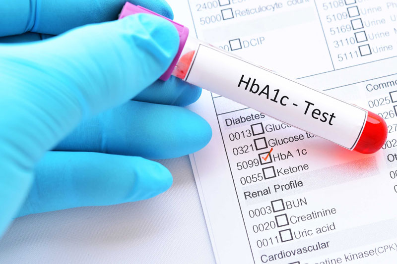Tầm quan trọng của xét nghiệm HbA1c trong điều trị tiểu đường | Medlatec